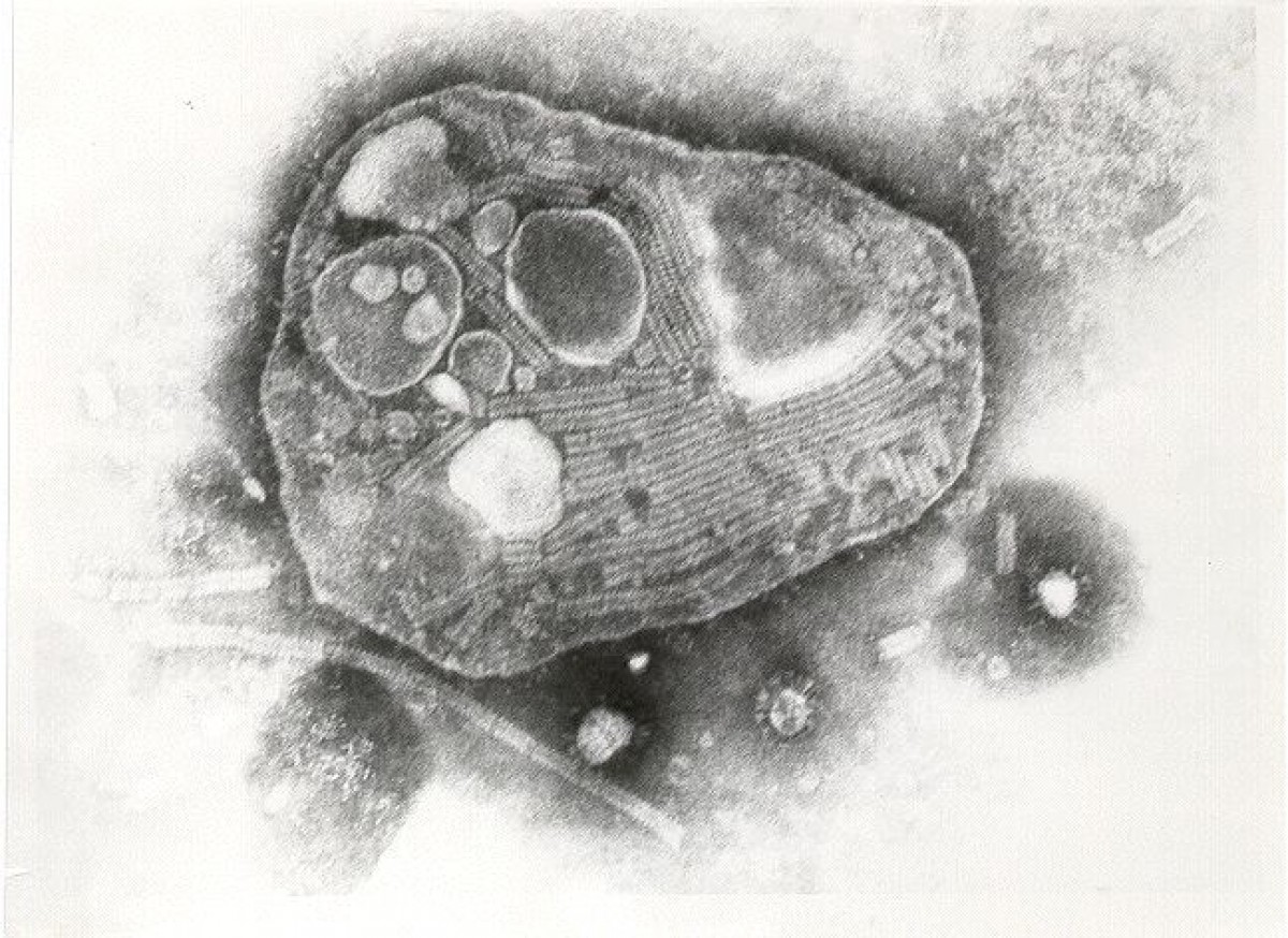 El virus de la peste bovina (imagen: Wikipedia)