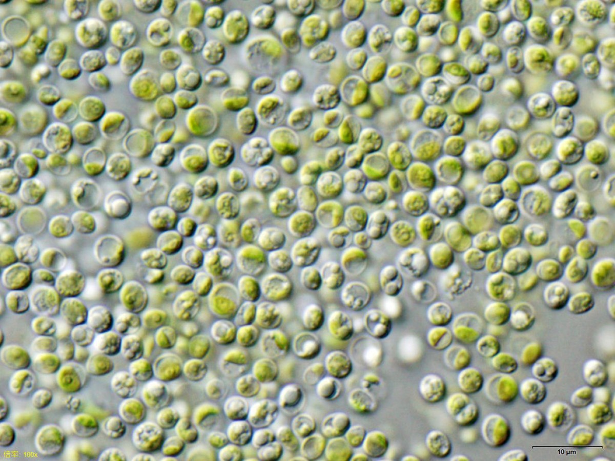 <em>Chlorella vulgaris</em> (Imagen: Wikipedia).