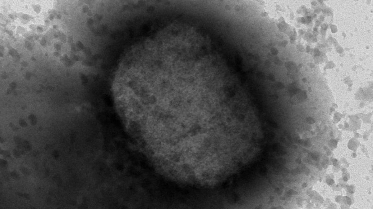 Imagen del virus de la viruela del mono obtenida por microscopía electrónica. (Imagen: ISCIII)