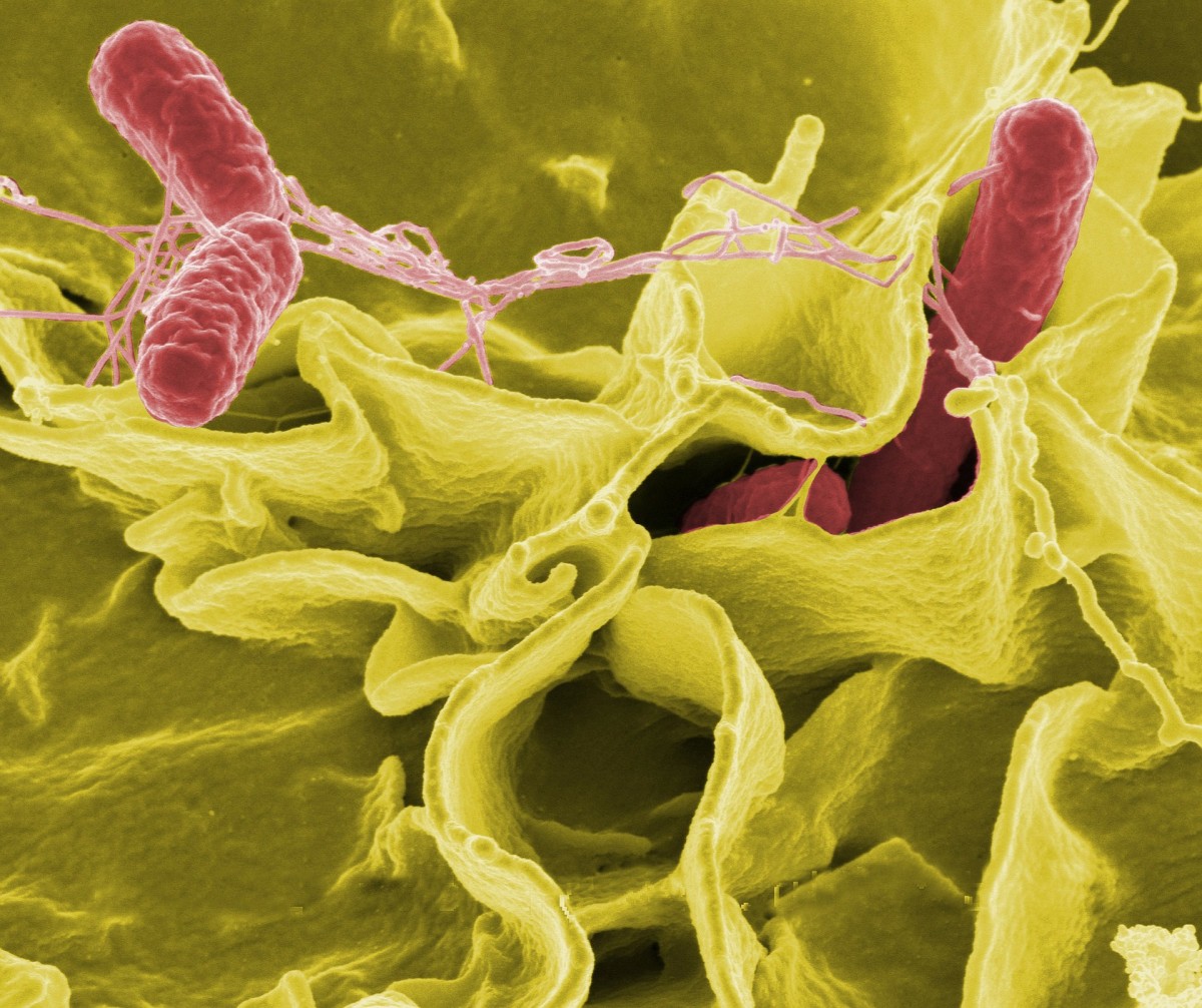 Imagen de la bacteria <em>Salmonella</em>.