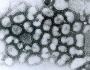 Micrografía electrónica del virus causante de la gripe aviar (Imagen del <em>Centers for Disease Control and Prevention</em>, EE. UU.)