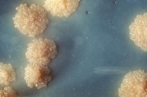 Aspecto típico de un cultivo de <em>Mycobacterium tuberculosis</em>